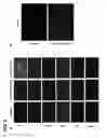 Fig. 09 - Method and Composition to Increase Radiation-Induced Tumor Therapeutic Effects