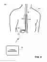 Fig. 07 - SYSTEMS AND METHODS FOR OPTOGENETIC MODULATION OF CELLS WITHIN A PATIENT