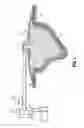 Fig. 02 - Negative Pressure Wound Therapy Dressing