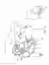 Fig. 07 - SYSTEMS AND METHODS FOR LEAD PLACEMENT OPTIMIZATION DURING LEAD IMPLANTATION