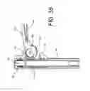 Fig. 35 - Pedicle screw extension for use in percutaneous spinal fixation