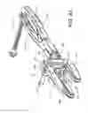 Fig. 43 - Pedicle screw extension for use in percutaneous spinal fixation