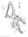 Fig. 45 - Pedicle screw extension for use in percutaneous spinal fixation