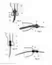 Fig. 05 - Stent graft with integral side arm