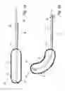 Fig. 02 - Cleaning device and system