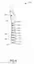 Fig. 09 - Oral care implement having a body disposed within the handle