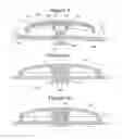 Fig. 02 - CLOSURES WITH MAGNETIC AND MECHANICAL SNAP FASTENING AND METHOD OF MAKING THE SAME