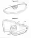 Fig. 06 - CLOSURES WITH MAGNETIC AND MECHANICAL SNAP FASTENING AND METHOD OF MAKING THE SAME