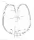 Fig. 01 - Ventilation interface for sleep apnea therapy