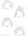 Fig. 02 - Custom dental appliance and method of creating a custom dental appliance