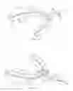 Fig. 09 - Custom dental appliance and method of creating a custom dental appliance