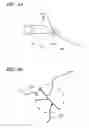 Fig. 09 - Separating device