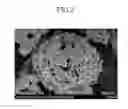 Fig. 03 - Positive active material for rechargeable lithium battery, method of preparing same and rechargeable lithium battery including same