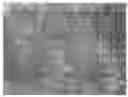 Fig. 01 - LASER ISOLATION OF VIABLE CELLS