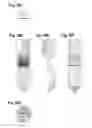 Fig. 43 - System and method for particle filtration