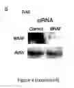 Fig. 08 - Methods for determining and inhibiting rheumatoid arthritis associated with the BRAF oncogene in a subject