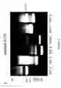 Fig. 09 - Methods for determining and inhibiting rheumatoid arthritis associated with the BRAF oncogene in a subject