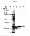 Fig. 06 - Calcium-binding photoprotein, gene encoding the same, and use thereof