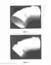 Fig. 03 - Pipe Vent Fitting