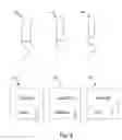 Fig. 05 - ARRAY OF PESSARY DEVICES
