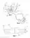 Fig. 02 - Implantable sling for the treatment of incontinence and method of using the same