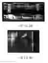 Fig. 34 - Neurophysiological stimulation system and methods with wireless communication