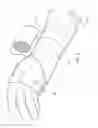 Fig. 08 - Moisture resistant moldable injury therapy device and method