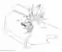 Fig. 01 - Distractor straps for use with distractor apparatuses