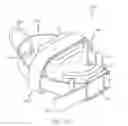 Fig. 03 - Distractor straps for use with distractor apparatuses