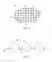 Fig. 02 - Clay-based hemostatic agents and devices for the delivery thereof