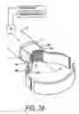 Fig. 04 - Medical instruments and techniques for treating pulmonary disorders