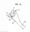 Fig. 07 - Expanding trial stem for orthopaedic surgery
