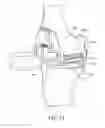 Fig. 33 - System for positioning a cutting guide in knee surgery