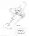 Fig. 34 - System for positioning a cutting guide in knee surgery