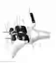 Fig. 55 - System for positioning a cutting guide in knee surgery