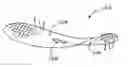 Fig. 01 - Reinforcement device with dissolvable layer and its use