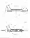Fig. 02 - RETRACTABLE INFLATABLE BONE TAMP