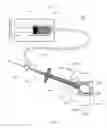 Fig. 09 - RETRACTABLE INFLATABLE BONE TAMP