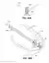 Fig. 45 - Retrievable cardiac devices