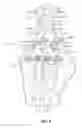 Fig. 07 - LUMBAR-SACRAL IMPLANT