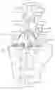 Fig. 01 - LUMBAR-SACRAL IMPLANT ALLOWING VARIABLE ANGLE FIXATION