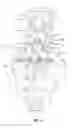 Fig. 09 - LUMBAR-SACRAL IMPLANT ALLOWING VARIABLE ANGLE FIXATION