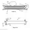 Fig. 06 - Stent