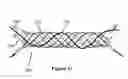 Fig. 07 - Stent