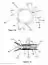 Fig. 09 - Stent