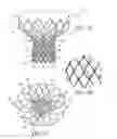 Fig. 02 - Heart Valve Prosthesis and Methods of Manufacture and Use