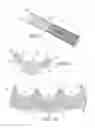 Fig. 03 - Heart Valve Prosthesis and Methods of Manufacture and Use