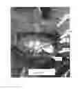 Fig. 03 - PORTABLE COMPACT FIRE CONTAINMENT RING DEVICE
