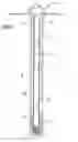Fig. 02 - Sliding stage cementing tool and method