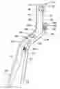 Fig. 01 - Valve handle for butterfly valve for bulk commodity hopper with tee